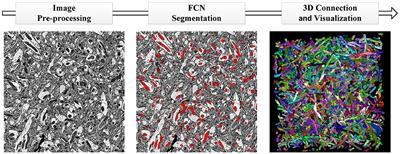 Automatic Mitochondria Segmentation for EM Data Using a 3D Supervised Convolutional Network